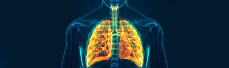 How to Get Rid of Fungal Infection in Lungs