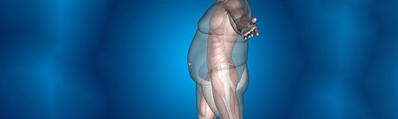 Is Obesity an Eating Disorder Is Obesity an Eating Disorder