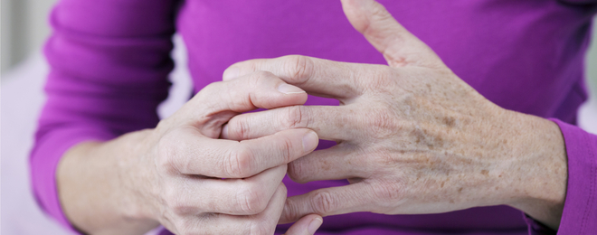 Is Rheumatoid Arthritis Hereditary