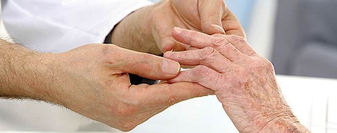 10 Types Of Arthritis Pain And The Treatments