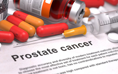 Casodex For Prostate Cancer