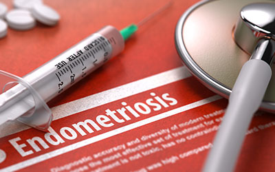 Danocrine For Endometriosis