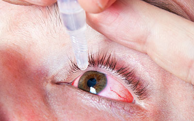 Zymar Eye Drops